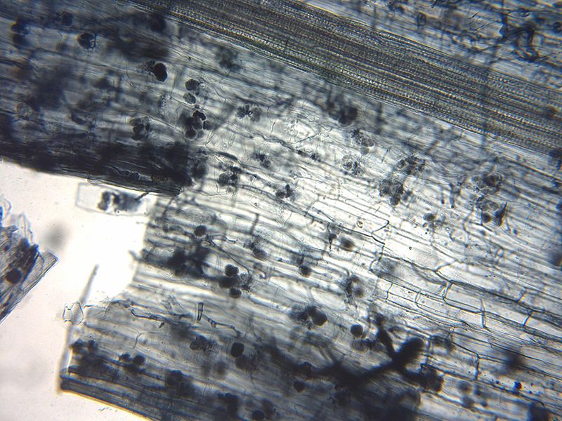 菌根 mycorrhiza の顕微鏡写真