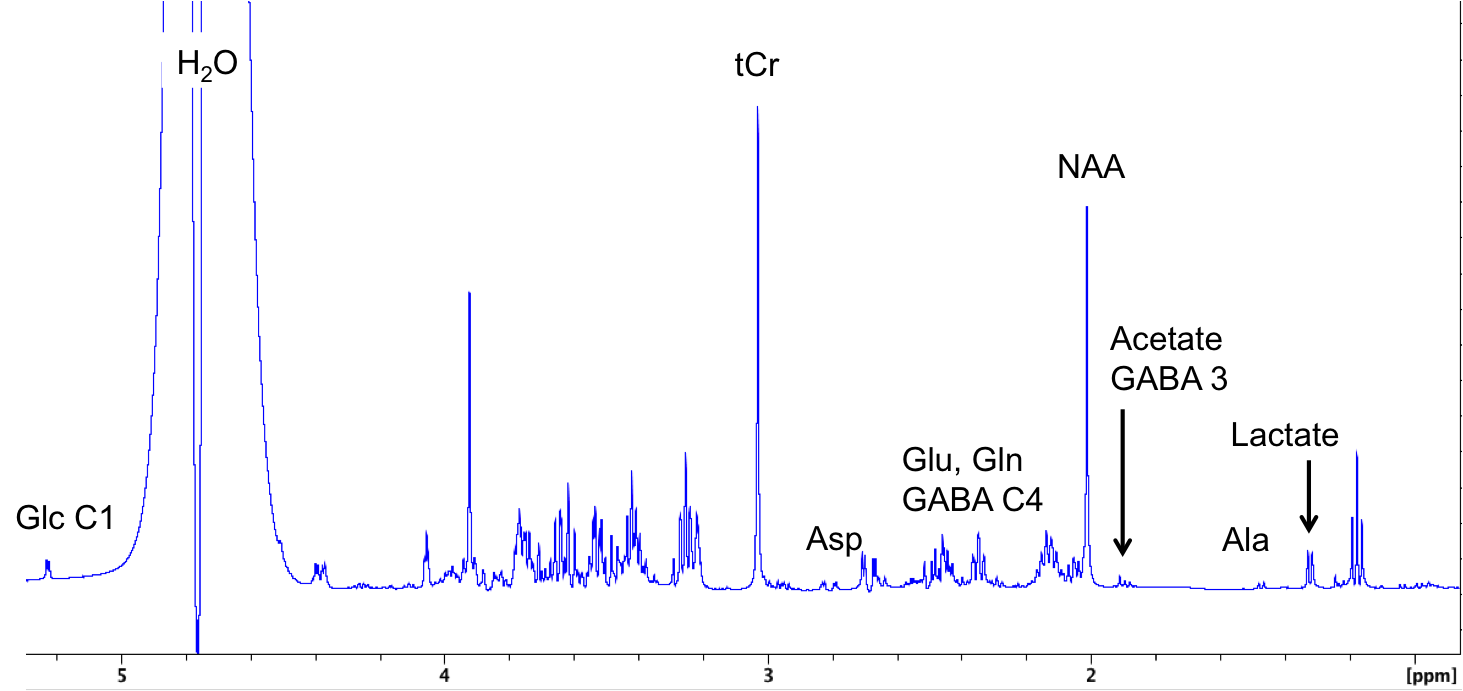 図 2. ラット脳抽出物のH-NMR