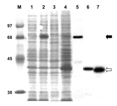 リコンビナントタンパク質の発現 SDS-PAGE