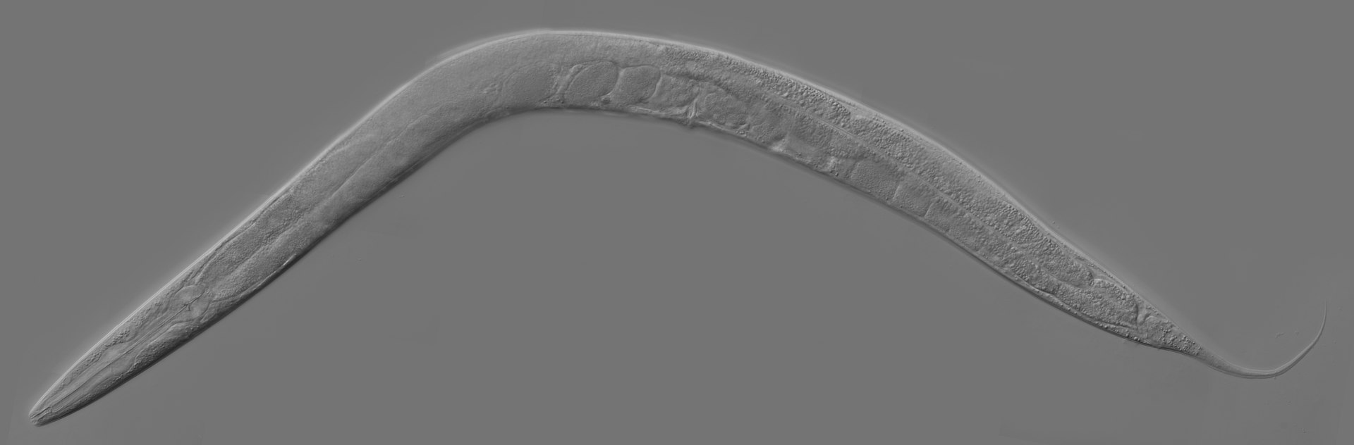 C. elegans の写真