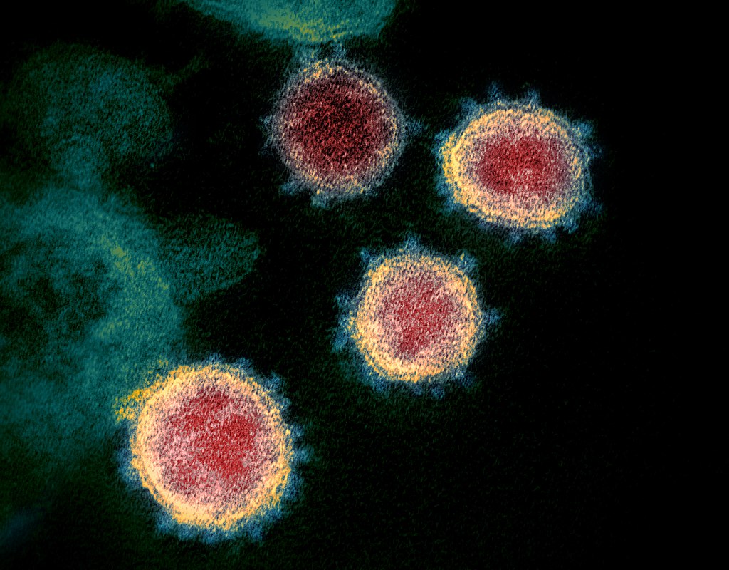 SARS-CoV-2 コロナウイルス
