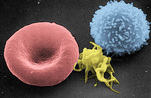 血球細胞の電子顕微鏡写真。左から赤血球、活性化した血小板および白血球。