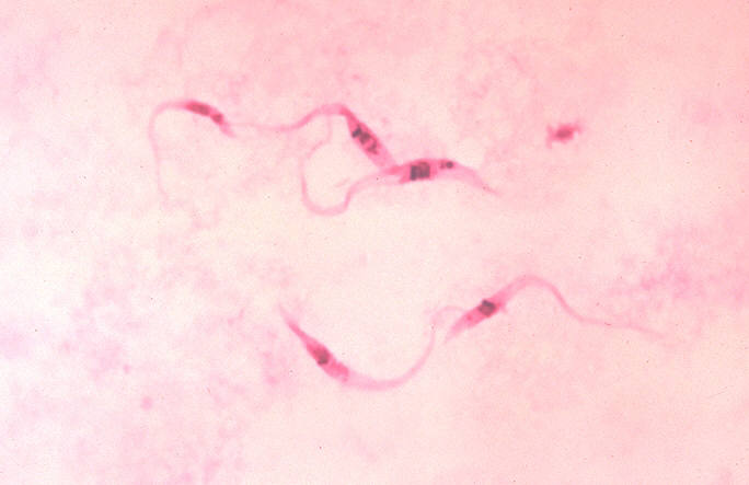 トリパノゾーマのギムザ染色像